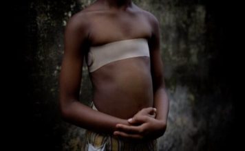 Qué es el planchado de senos que algunas madres utilizan para evitar que los hombres se acerquen a sus hijas