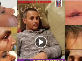 Taxista dominicano en New Jersey sufre agresión de parte de un delincuente