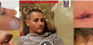 Taxista dominicano en New Jersey sufre agresión de parte de un delincuente