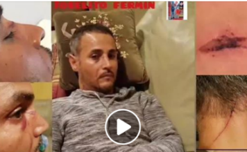 Taxista dominicano en New Jersey sufre agresión de parte de un delincuente