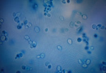 La misteriosa infección que se esparce por el mundo debido a la resistencia a antimicóticos