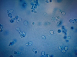 La misteriosa infección que se esparce por el mundo debido a la resistencia a antimicóticos