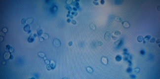 La misteriosa infección que se esparce por el mundo debido a la resistencia a antimicóticos