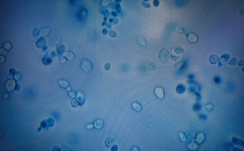 La misteriosa infección que se esparce por el mundo debido a la resistencia a antimicóticos