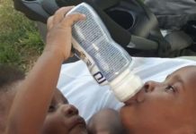 No pueden ser separadas las siamesas nacidas en la Maternidad Nuestra Señora de la Altagracia