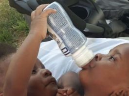 No pueden ser separadas las siamesas nacidas en la Maternidad Nuestra Señora de la Altagracia