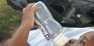 No pueden ser separadas las siamesas nacidas en la Maternidad Nuestra Señora de la Altagracia