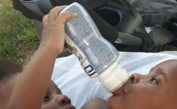 No pueden ser separadas las siamesas nacidas en la Maternidad Nuestra Señora de la Altagracia