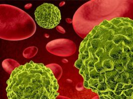 Muertes por cáncer se reducirían con estudios especializados