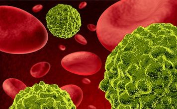 Muertes por cáncer se reducirían con estudios especializados