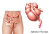 Apendicitis: causas y síntomas