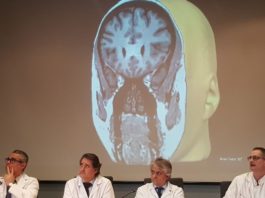 Primera cirugía láser en España para tratar la epilepsia y tumores cerebrales
