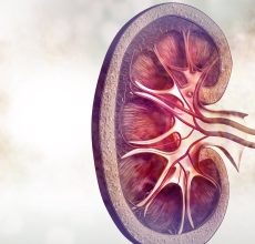 Implicaciones del trasplante de riñón