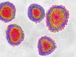 Coronavirus llega a América: Estados Unidos registra el primer infectado