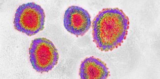 Coronavirus llega a América: Estados Unidos registra el primer infectado