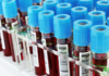 Gobierno declara de urgencia compra de equipos para enfrentar eventual llegada de coronavirus