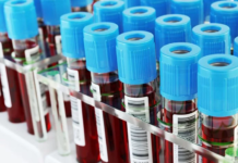 Gobierno declara de urgencia compra de equipos para enfrentar eventual llegada de coronavirus