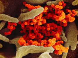 Coronavirus: las imágenes microscópicas que revelan detalles del virus que tiene en alerta al mundo