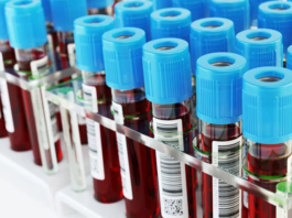 Gobierno declara de urgencia compra de equipos para enfrentar eventual llegada de coronavirus