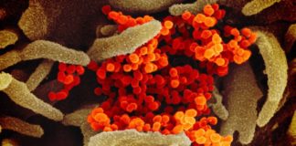 Coronavirus: las imágenes microscópicas que revelan detalles del virus que tiene en alerta al mundo