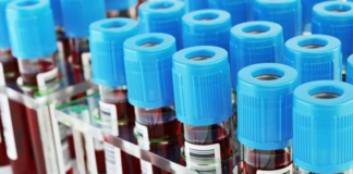 Gobierno declara de urgencia compra de equipos para enfrentar eventual llegada de coronavirus