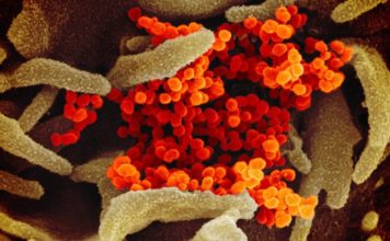 Coronavirus: las imágenes microscópicas que revelan detalles del virus que tiene en alerta al mundo