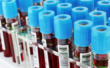 Gobierno declara de urgencia compra de equipos para enfrentar eventual llegada de coronavirus
