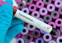 Índice de mortalidad por coronavirus en el país es de 1.48%