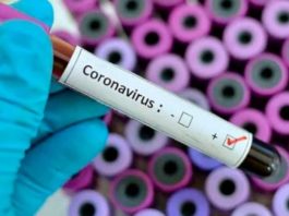 Índice de mortalidad por coronavirus en el país es de 1.48%