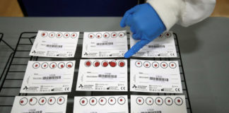 Hombre da positivo por coronavirus 15 veces en menos de tres meses