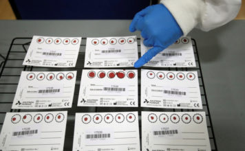 Hombre da positivo por coronavirus 15 veces en menos de tres meses