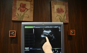 Indonesia, ante una posible explosión de la natalidad tras la pandemia