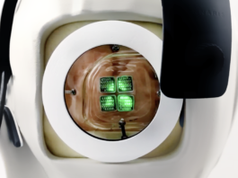 Científicos australianos se preparan para realizar el primer trasplante de ojo biónico a un humano