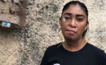 La historia de Esmeralda Millán, víctima de los ataques con ácido en México: «Me decía que si yo no era suya, no iba a ser de nadie. Lo dejé y me atacó»