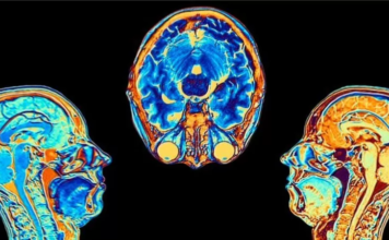 Covid: el estudio que muestra cómo cambia el cerebro tras una infección por coronavirus, aunque esta sea leve