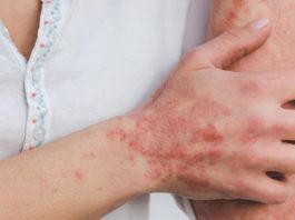 Higiene, elemento principal para evitar afección detectada en Haití