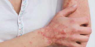 Higiene, elemento principal para evitar afección detectada en Haití