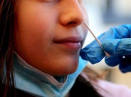 Se elevan a 1,028 los casos activos de Covid-19 en RD