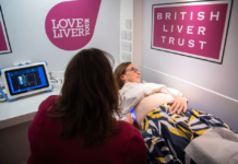 Mensaje de los hepatólogos para cuidar el hígado: tres días seguidos a la semana sin probar el alcohol (al menos)