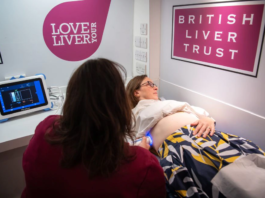 Mensaje de los hepatólogos para cuidar el hígado: tres días seguidos a la semana sin probar el alcohol (al menos)