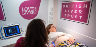 Mensaje de los hepatólogos para cuidar el hígado: tres días seguidos a la semana sin probar el alcohol (al menos)