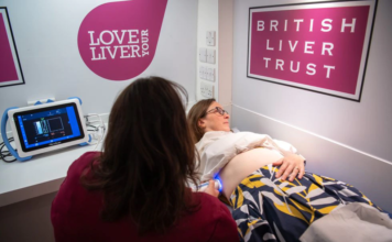 Mensaje de los hepatólogos para cuidar el hígado: tres días seguidos a la semana sin probar el alcohol (al menos)