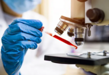 Un análisis de sangre podría detectar cáncer antes de que aparezcan síntomas