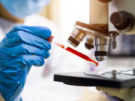 Un análisis de sangre podría detectar cáncer antes de que aparezcan síntomas