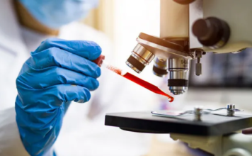 Un análisis de sangre podría detectar cáncer antes de que aparezcan síntomas
