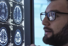 Alzheimer: el medicamento aclamado como un avance trascendental en la lucha contra la enfermedad