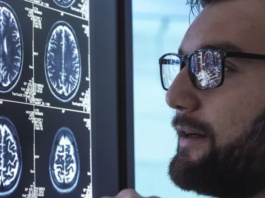 Alzheimer: el medicamento aclamado como un avance trascendental en la lucha contra la enfermedad