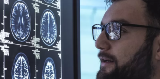 Alzheimer: el medicamento aclamado como un avance trascendental en la lucha contra la enfermedad