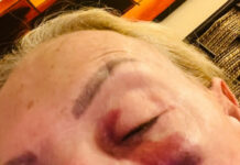 Laura Bozzo sufrió caída durante un ataque de ansiedad