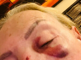 Laura Bozzo sufrió caída durante un ataque de ansiedad